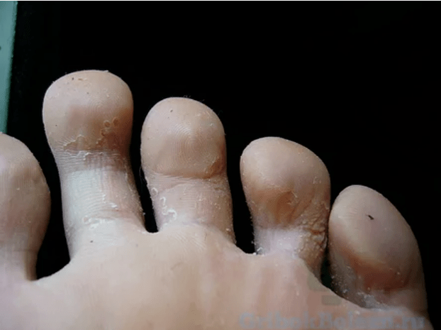 Mantarın aşamaları